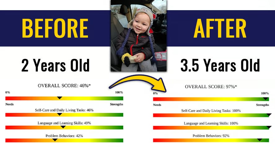 autism assessment. BECA scores. Mary Barbera Autism Assessment.